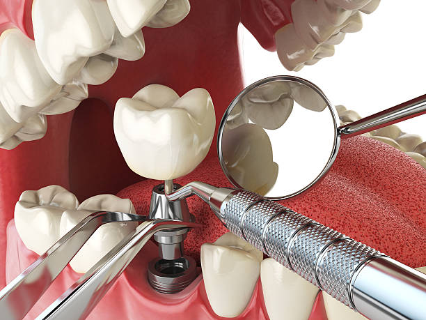 Best Emergency Dental Surgery in Dyersville, IA